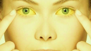 Důsledná hygiena nemusí v prevenci žloutenky typu A stačit